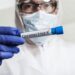 Arzt mit Gesichtsmaske und Handschuhen hält ein Reagenzglas mit einem Coronavirus-Test