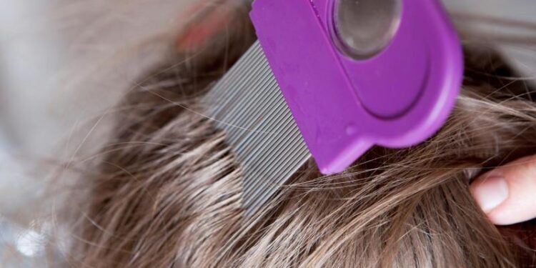 Ein spezieller Läusekamm wird durch die Haare einer Person gestrichen.