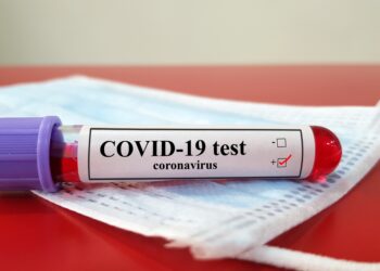 Wie zuverlässig ist der Einsatz von Antikörpertests zur Diagnose von COVID-19? (Bild: Joel bubble ben/Stock.Adobe.com)
