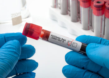 Mit Blut gefüllter Coronavirus-Antikörpertest