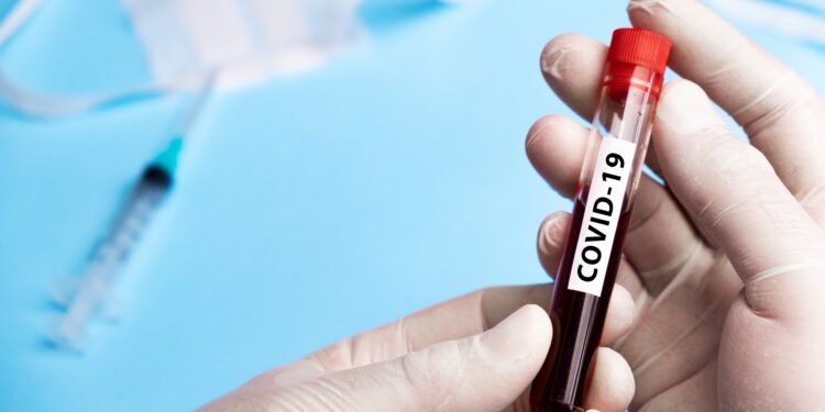 Qualcuno che fa un esame del sangue dice "COVID-19" nelle mani.