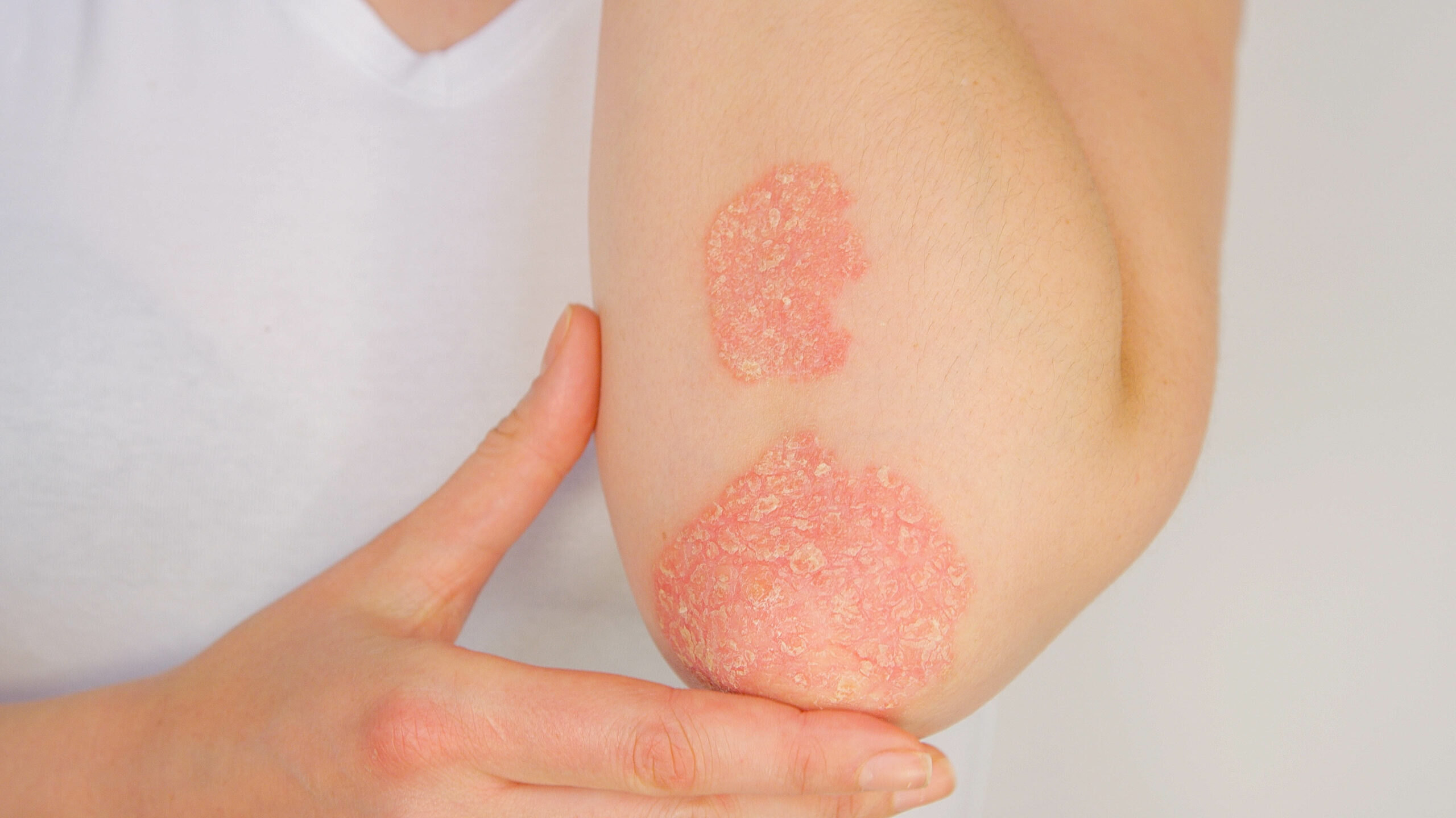 New technology enables better treatment of skin diseases – a medical practice