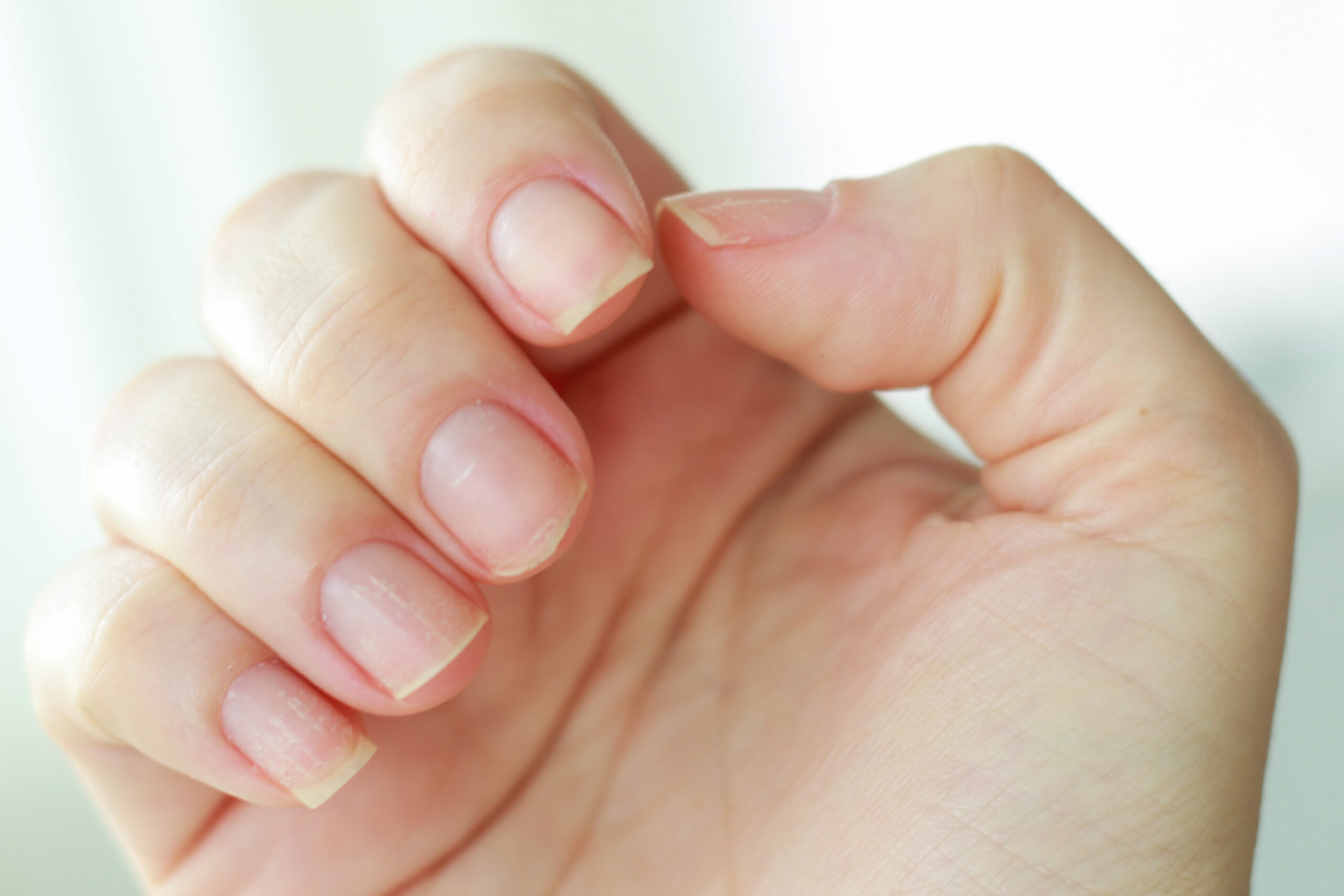 Lo que las uñas revelan sobre la salud: la práctica de curar