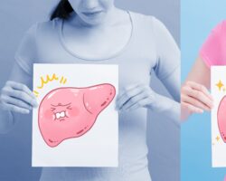 Eine Frau hält auf der linken Seite eine Zeichnung mit einer Fettleber und auf der rechten Seite eine Zeichnung mit einer gesunden Leber in der Hand.