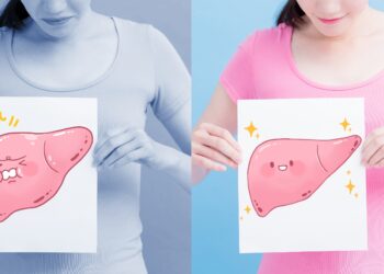 Eine Frau hält auf der linken Seite eine Zeichnung mit einer Fettleber und auf der rechten Seite eine Zeichnung mit einer gesunden Leber in der Hand.