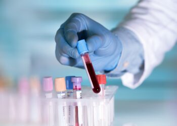 Werden wir in Zukunft mehr als 50 Arten von Krebs einfach mit einem Bluttest diagnostizieren können? (Bild: angellodeco/Stock.Adobe.com)
