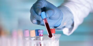 Werden wir in Zukunft mehr als 50 Arten von Krebs einfach mit einem Bluttest diagnostizieren können? (Bild: angellodeco/Stock.Adobe.com)