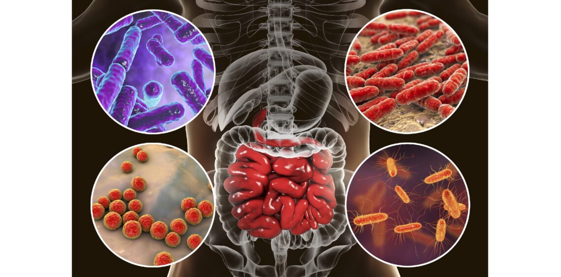 Immunsystem: Darmbakterien beeinflussen Antikörper-Produktion – Heilpraxis
