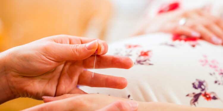 Hebamme behandelt Schwangere mit Akupunktur
