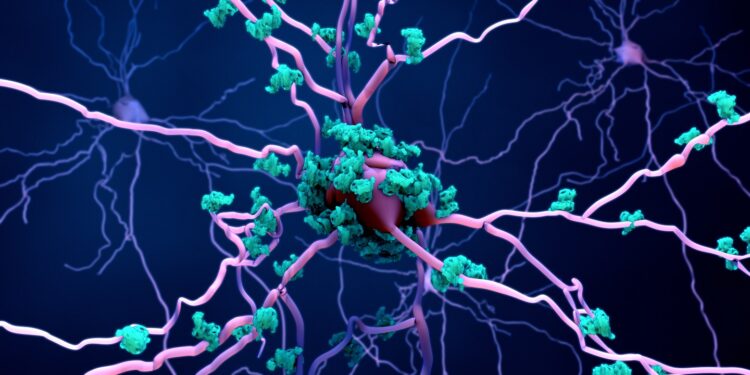 Darstellung von Neuronen mit Tau-Protein-Ablagerungen.