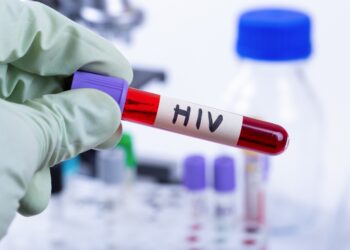 Blutprobe mit HIV in einem Labor.
