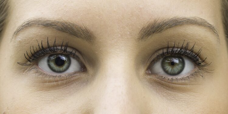 Das Augenpaar einer Frau. Die linke Pupille ist erweitert und die rechte zusammengezogen.