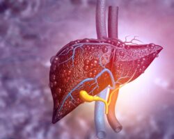 Darstellung der Leber mit Fetteinlagerungen.