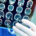 Ärztin betrachtet MRT-Aufnahmen des Gehirns