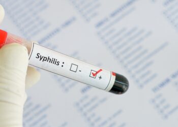 Probenröhrchen mit der Aufschrift Syphilis.