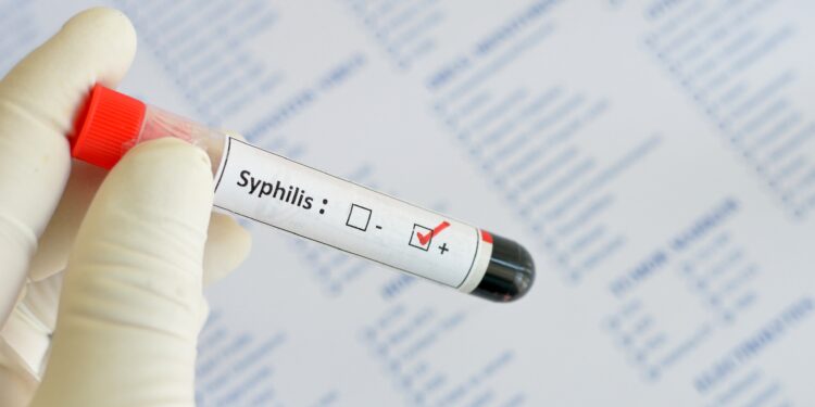 Probenröhrchen mit der Aufschrift Syphilis.