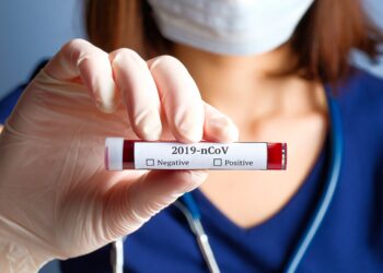 Krankenschwester hält Reagenzglas mit Blut für die SARS-CoV-2-Analyse