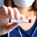 Krankenschwester hält Reagenzglas mit Blut für die SARS-CoV-2-Analyse