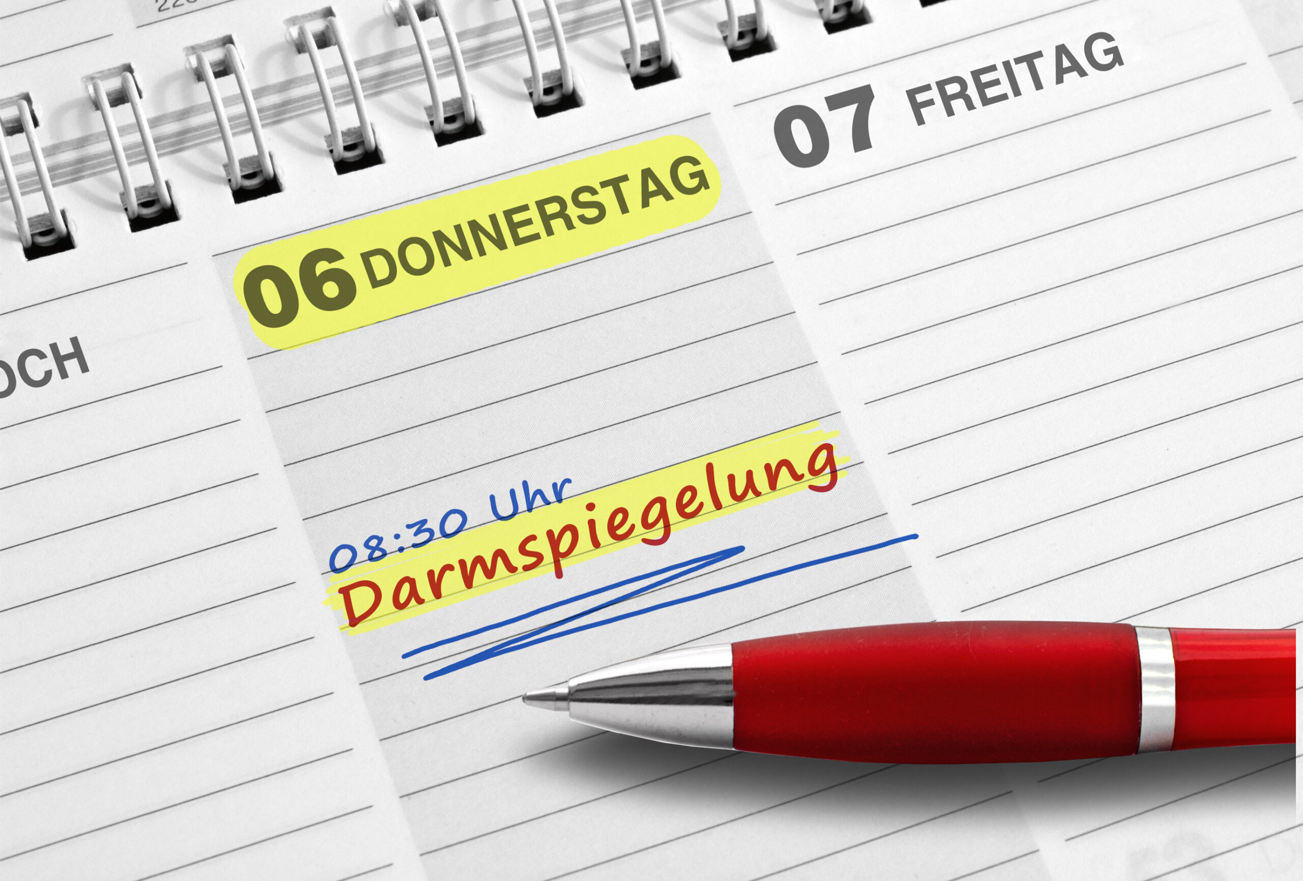 Darmkrebs: Wie lässt er sich verhindern und wann sollte man sich untersuchen lassen? - Vimarsana News