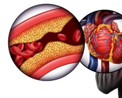 Bildliche Darstellung von Ldl im Blut.