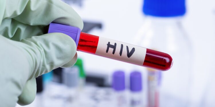 Ampulle mit Blutprobe mit HIV.