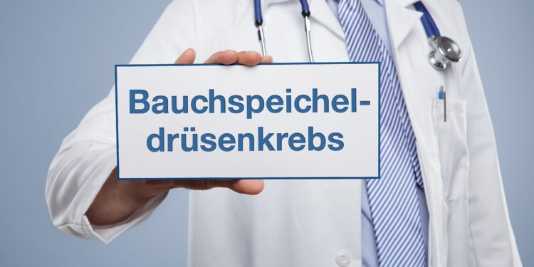 Arzt hält ein Schild mit der Aufschrift Bauchspeicheldrüsenkrebs