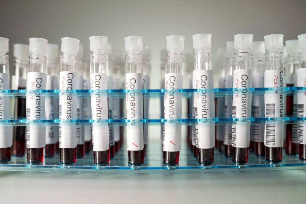 Mehrere mit Blut gefüllte Coronavirus-Test-Ampullen