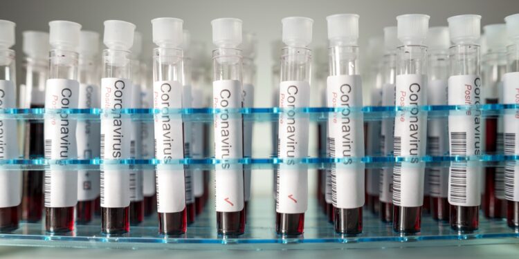 Mehrere mit Blut gefüllte Coronavirus-Test-Ampullen