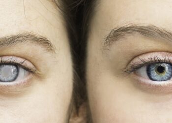 Die Einnahme von hormonellen Verhütungsmitteln ist mit einem erhöhten Risiko für Glaukome verbunden. (Bild: Alessandro Grandini/stock.adobe.com)