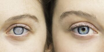 Die Einnahme von hormonellen Verhütungsmitteln ist mit einem erhöhten Risiko für Glaukome verbunden. (Bild: Alessandro Grandini/stock.adobe.com)