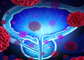 Darstellung Prostata mit Tumor und Krebszellen