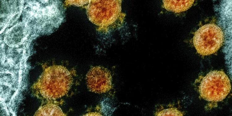 Eine elektronenmikroskopische Aufnahme zeigt Partikel des Coronavirus SARS-CoV-2.