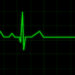 Ein Elektrokardiogramm