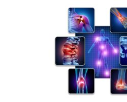 Gelenkschmerzen an verschiedenen Stellen des Körpers hervorgehoben.