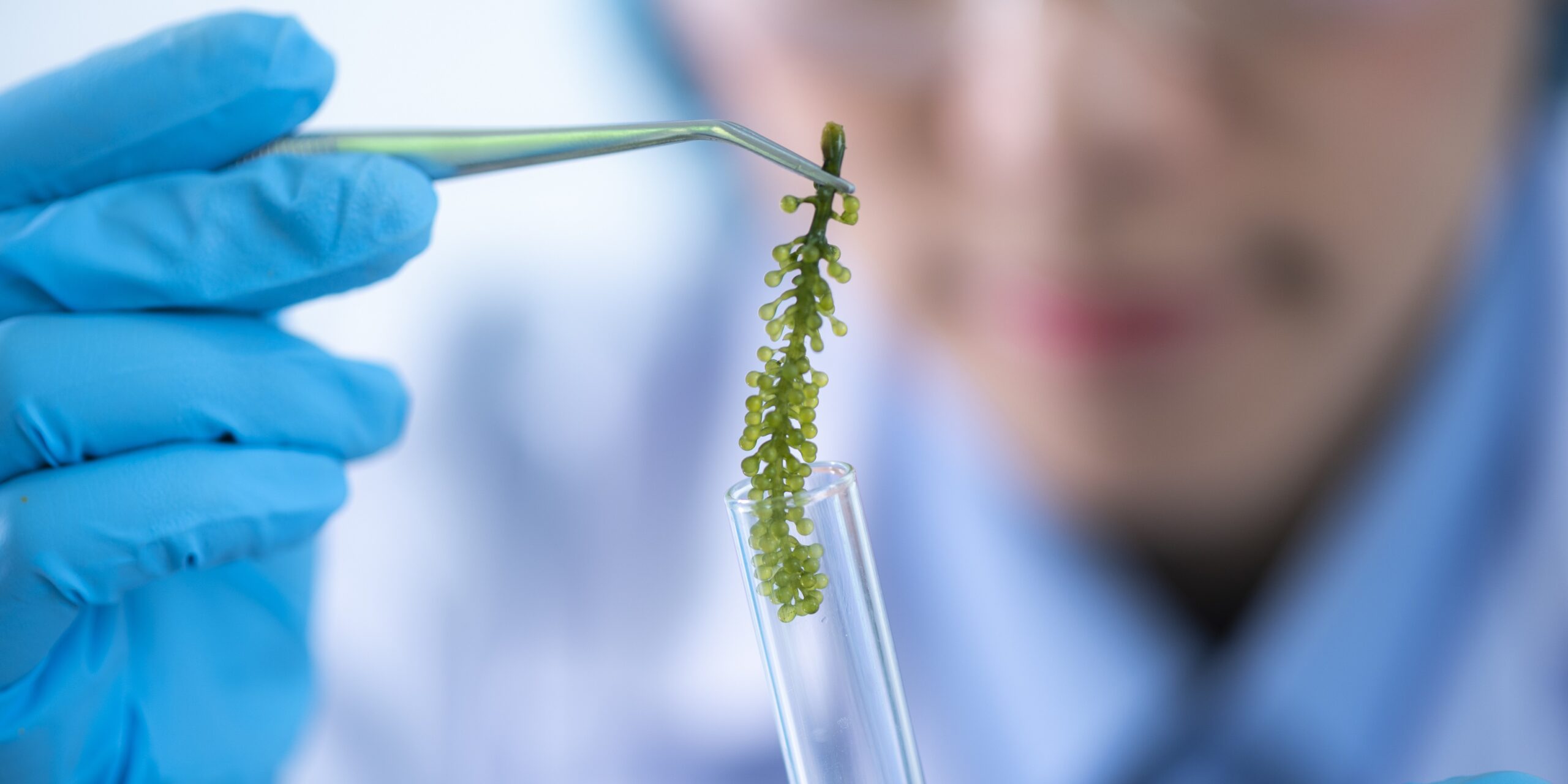 Alge-reduziert-K-rperfett-verbessert-Darmflora