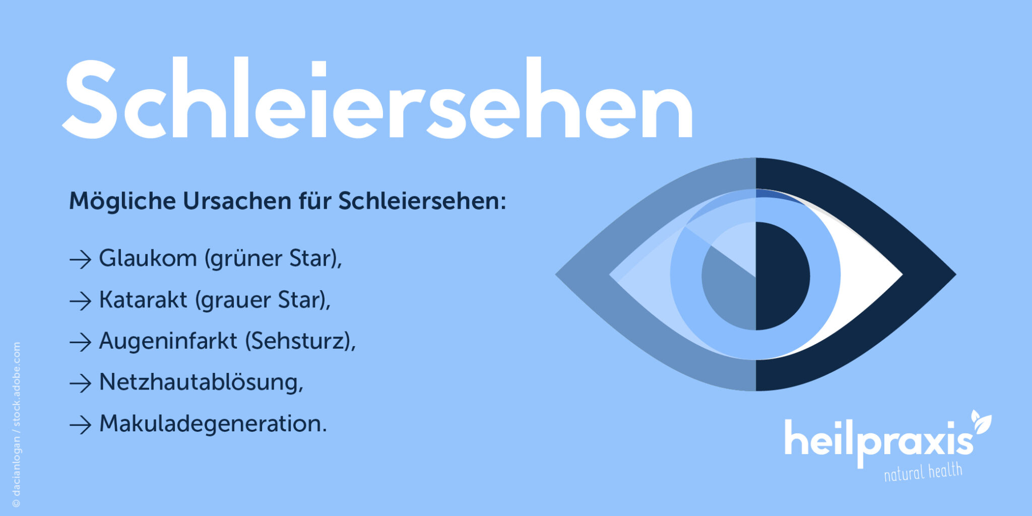 Schleiersehen Schleier vor den Augen Heilpraxis