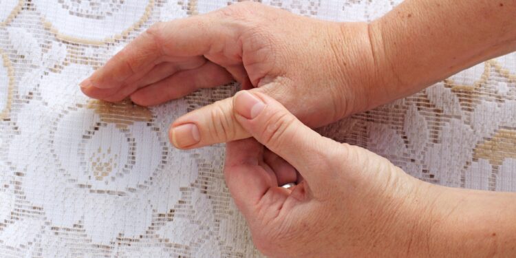 Für ein Anschwellen der Hände kann es vielerlei Gründe geben, von Hitze bis hin zu krankhaften Ursachen, die medizinisch abgeklärt werden sollten. (Bild: Astrid Gast/stock.adobe.com)