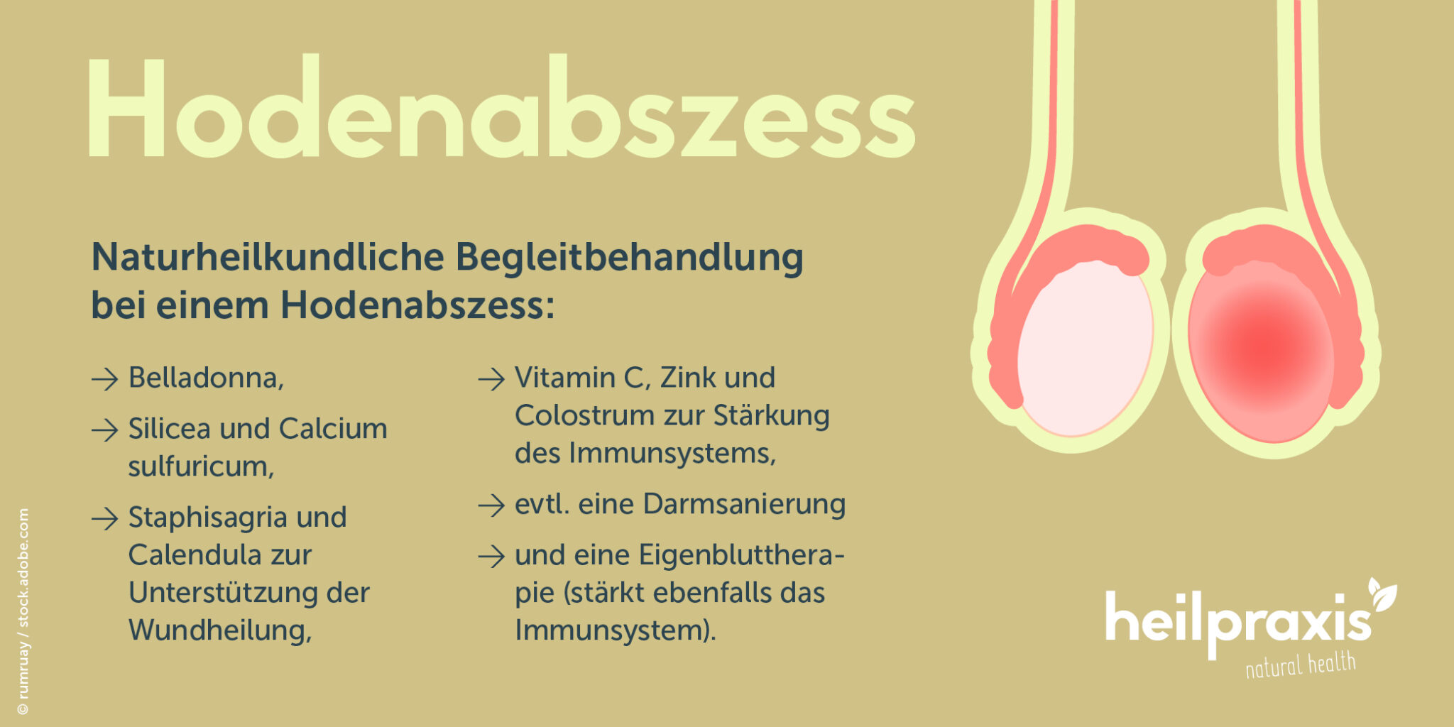 Hodenabszess – Ursachen, Diagnose und Behandlung – Heilpraxis