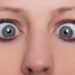 Frau mit schielenden Augen