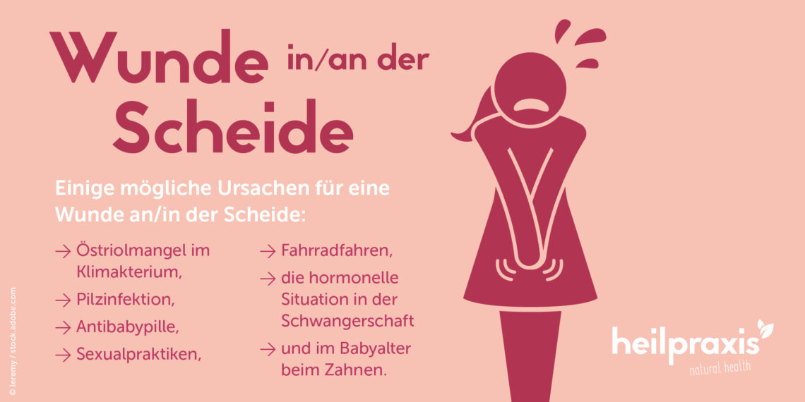 Wunde an der Scheide Ursachen, Symptome und Behandlung Heilpraxis