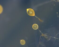 Mikroskop-Aufnahme der Amöbe Dictyostelium discoideum.