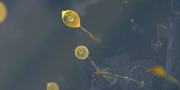 Mikroskop-Aufnahme der Amöbe Dictyostelium discoideum.