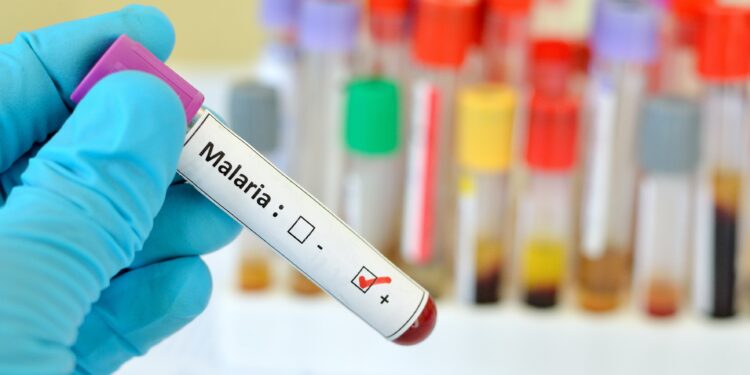 Behandschuhte Hand mit einer positiven Malaria-Blutprobe