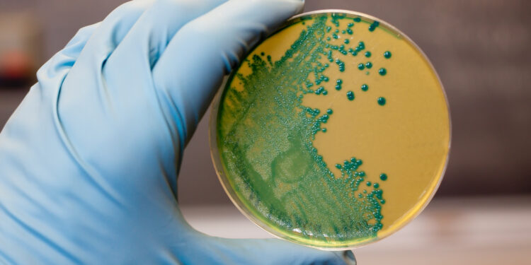 Behandschuhte Hand hält eine Petrischale mit Listerien