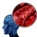 Digitale Darstellung eines Blutgefäßes und eines Gehirns.