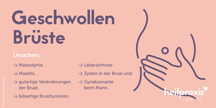 Ursachen für geschwollene Brüste