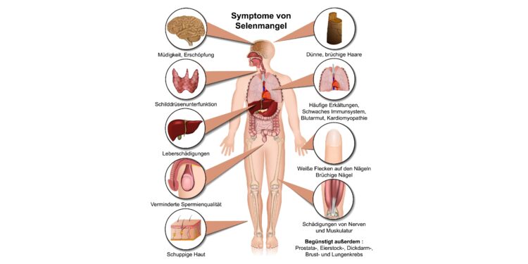 Ein Schaubild über Beschwerden, die bei einem Mangel an Selen auftreten können.