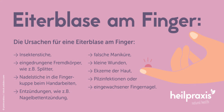 Ursachen für eine Eitrerblase am Finger - Infografik