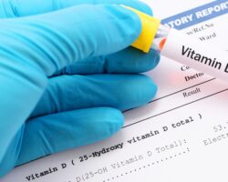 Hand mit blauem Handschuh hält ein mit Vitamin D-Test beschriftetes Probenröhrchen über ein Blatt mit Daten einer Analyse von Vitamin D im Blut