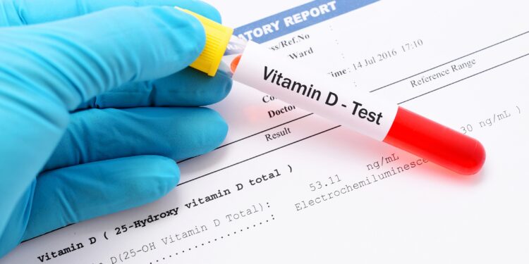 Hand mit blauem Handschuh hält ein mit Vitamin D-Test beschriftetes Probenröhrchen über ein Blatt mit Daten einer Analyse von Vitamin D im Blut